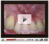 rfsystemlab wireless dental monitor system - doga video recording